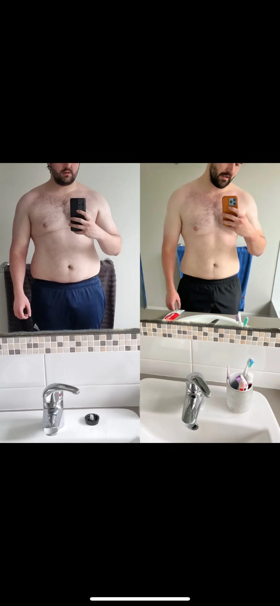 Zac before and after transformation